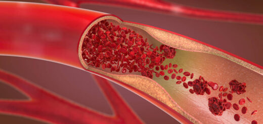 Investigadores consiguen reducir el colesterol malo inactivando un gen