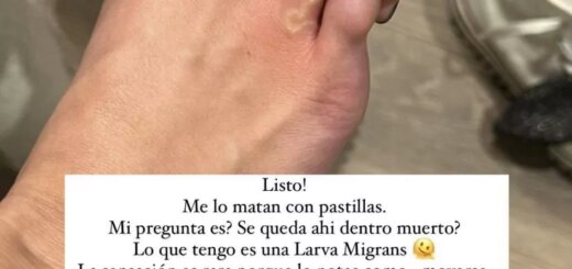 Larva migrans, el gusano que crece y se mueve bajo la piel de la influencer Lucía Pombo